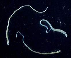 Hymenolepiasis